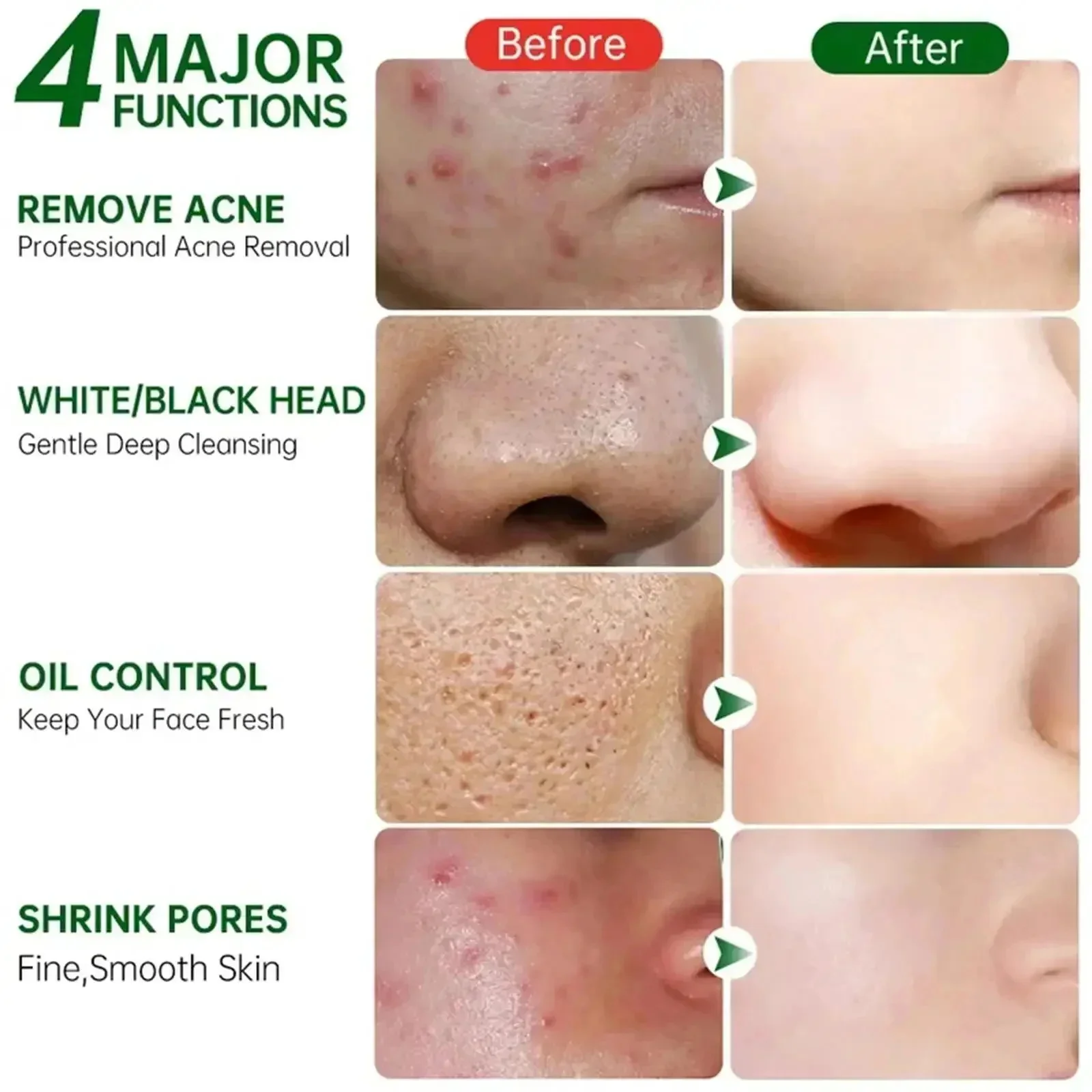 Salicylic Acid Pore Clearing C - Salicylic Acid Blackhead Remover review and price