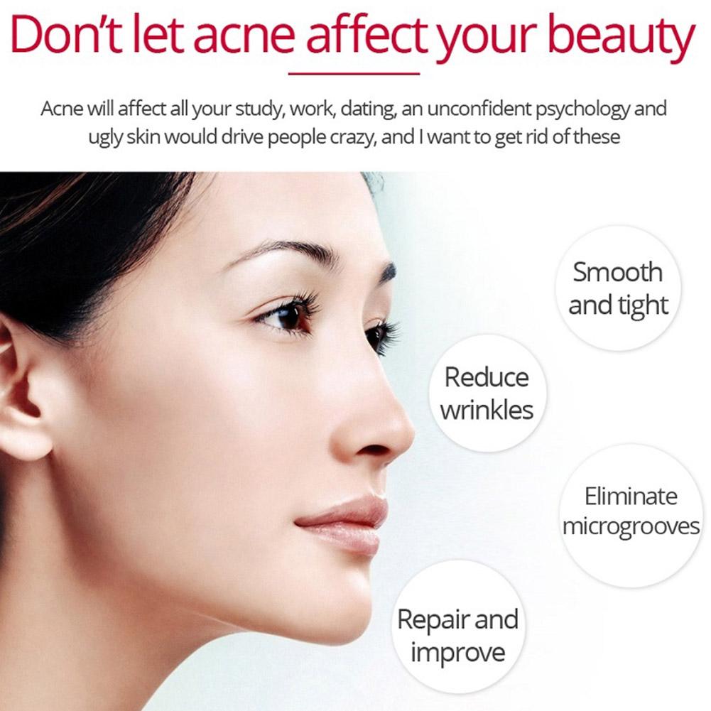 Retinol Lifting Firming Cream  - Retinol Anti Wrinkle Cream review and price