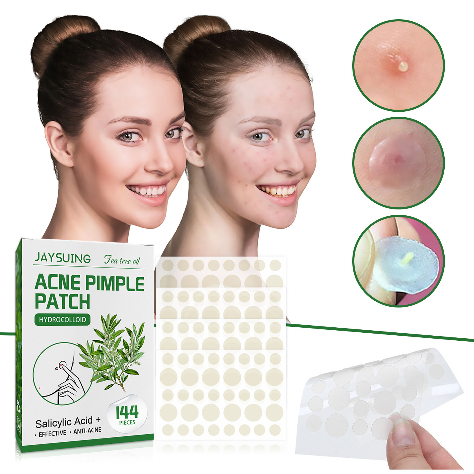 Hydrocolloid Acne Patches - Ab - Hydrocolloid Pimple Patch review and price
